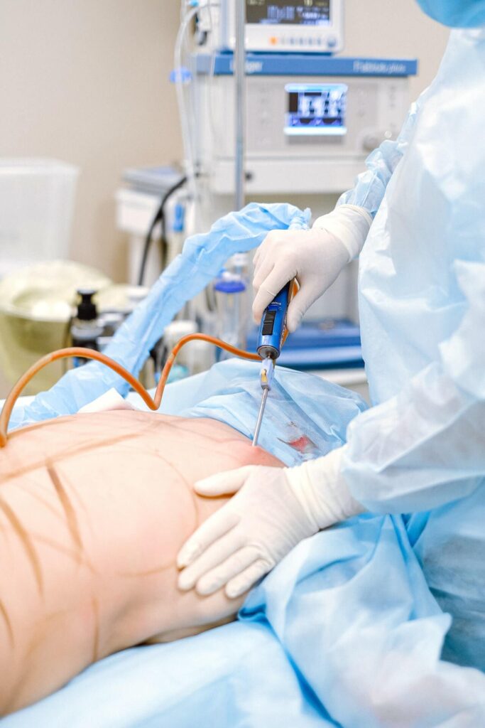 a surgeon performing vaser liposuction