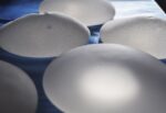 Breast Reduction Feature Image