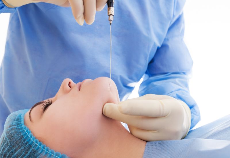 Chin liposuction