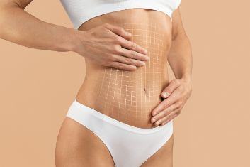 Someone who just had a tummy tuck