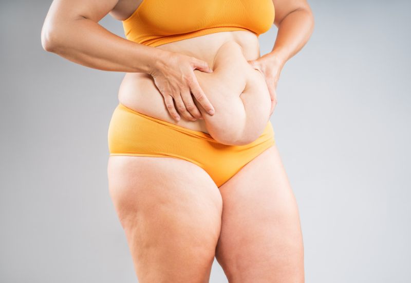 someone who needs a tummy tuck