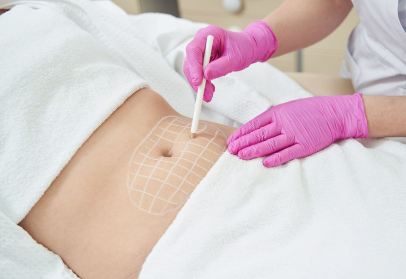 non invasive plastic surgery