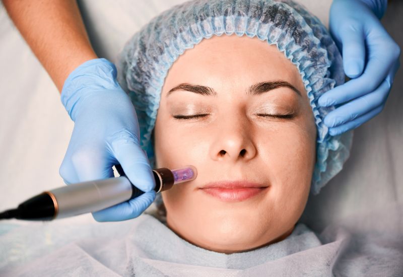 facial rejuvenation