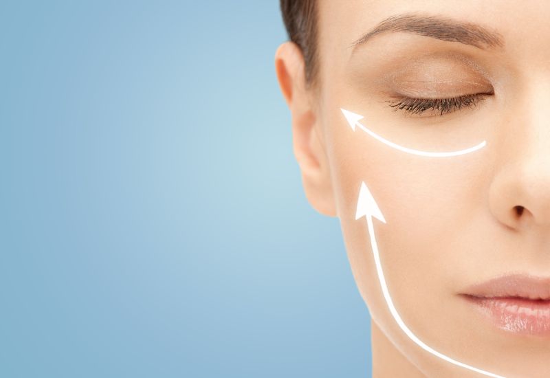 what is a facelift