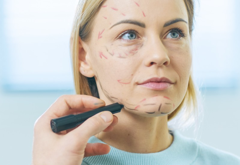 reducing time after a facelift
