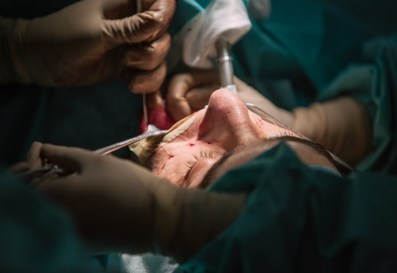 chin surgery