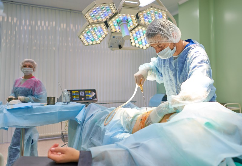 liposuction surgery