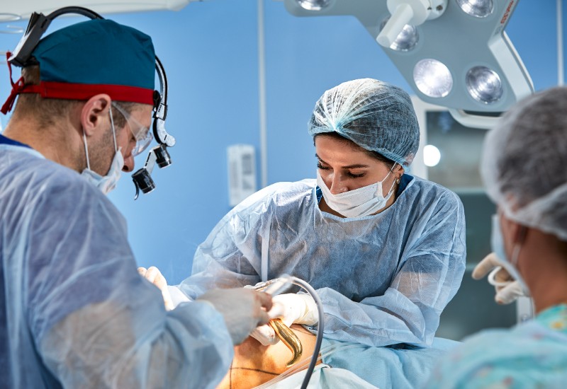 liposuction surgery