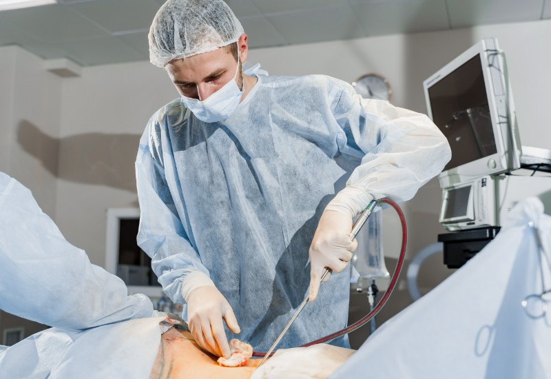 liposuction surgeons performing surgery.