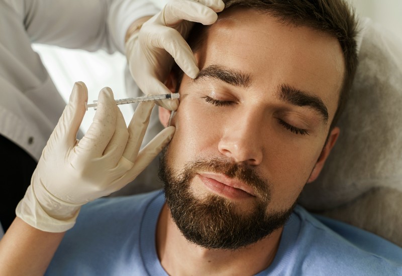 male dermal fillers