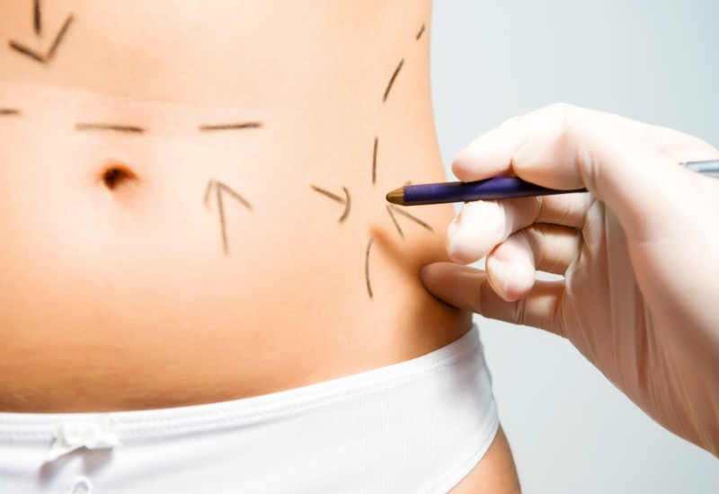 types of plastic surgery - feature image