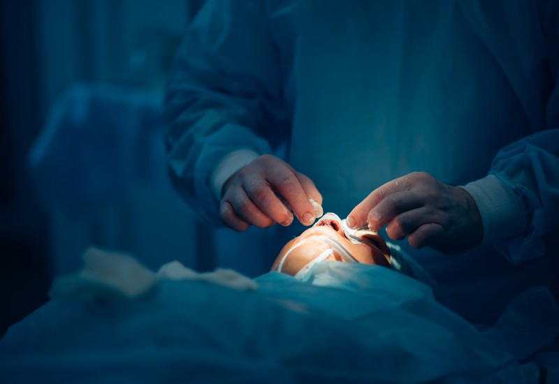 rhinoplasty surgeon working on patient