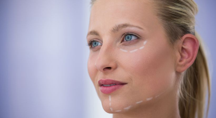 woman having her treatment areas marked