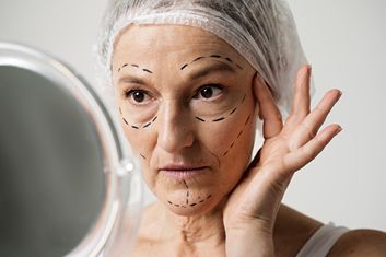 Older woman examining her face in the mirror before cosmetic surgery, with pre-surgical markings visible