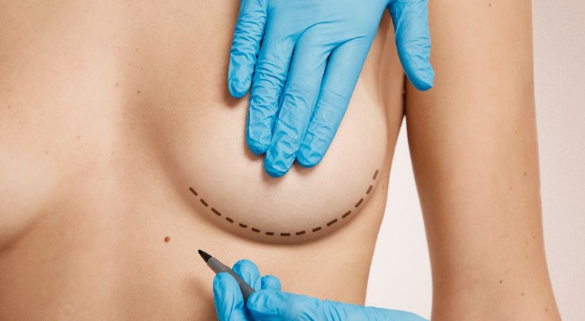 Woman being prepped for breast reduction