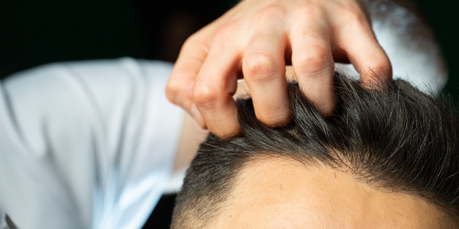 Male hairstyling after getting biofibre hair transplant