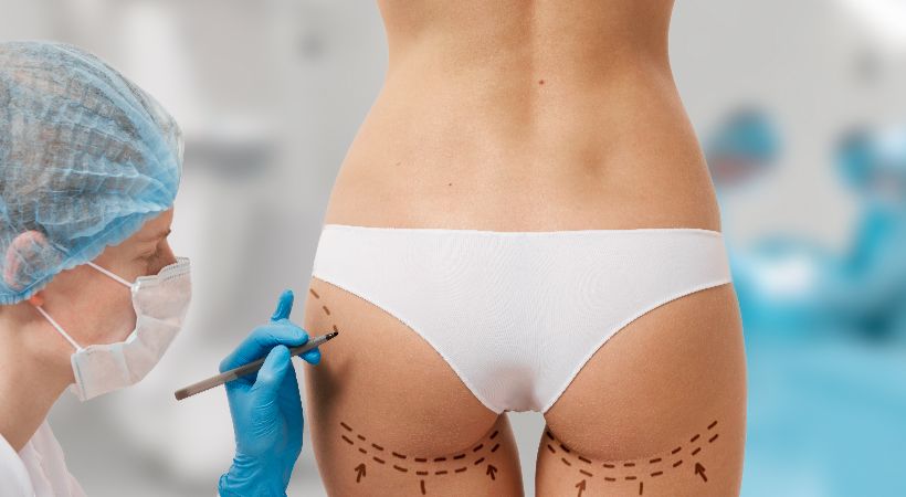 Woman being prepped for liposuction