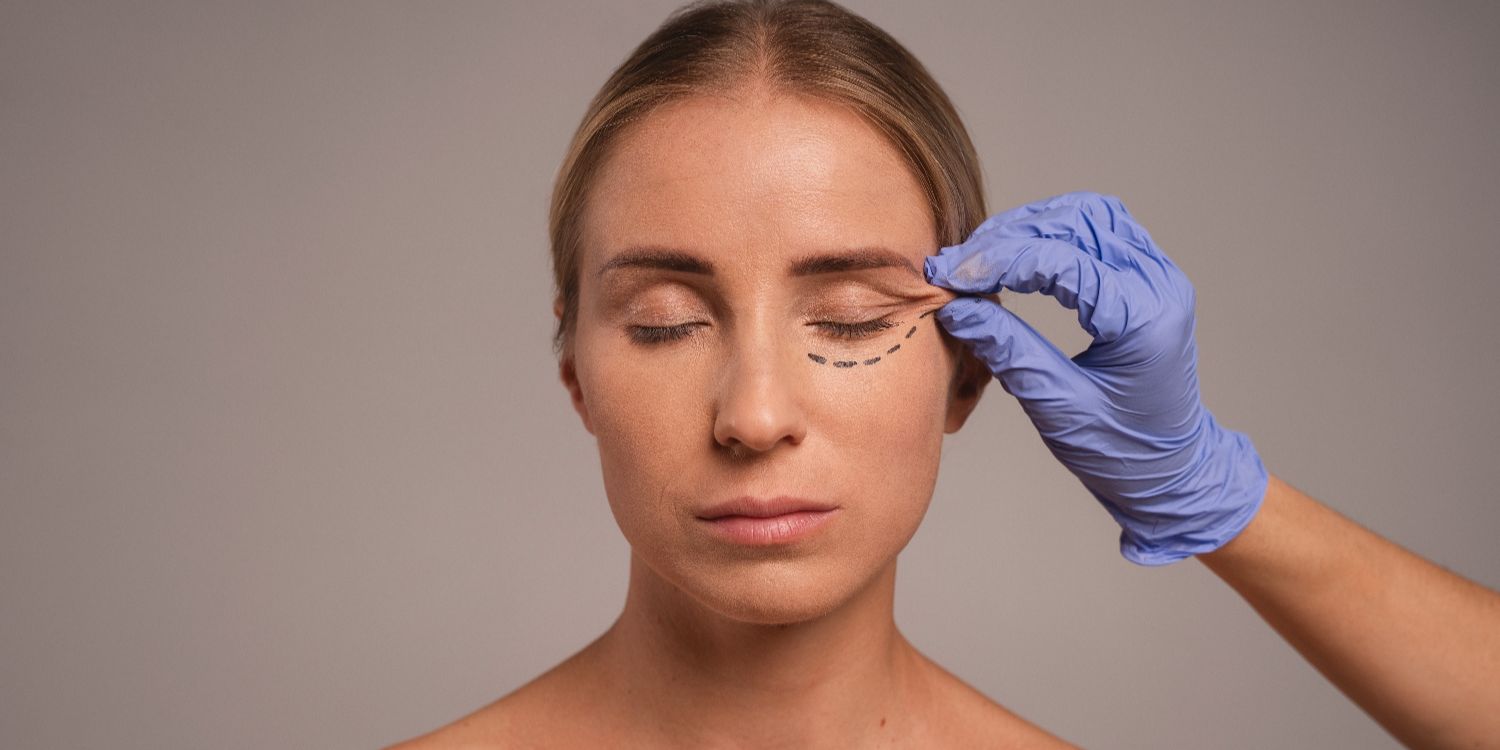 Someone being prepared for eyelid surgery