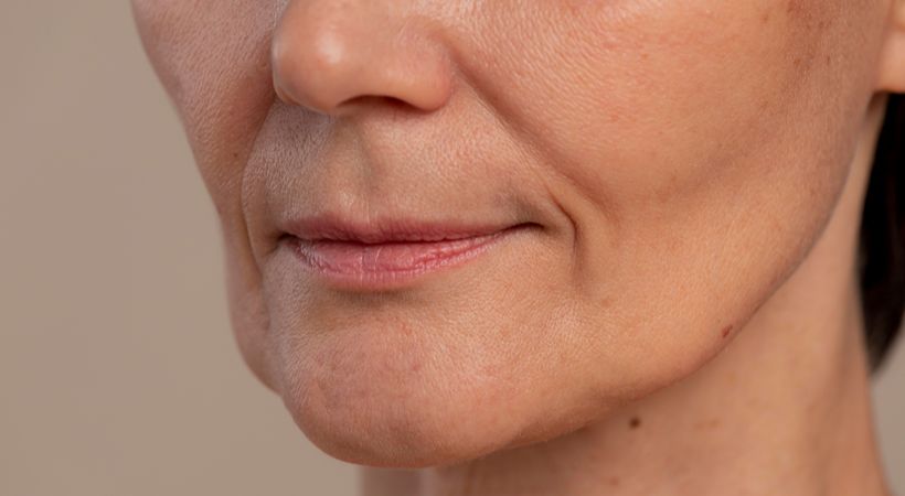 Woman with jowls