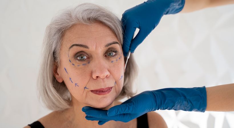 Woman having jowls treated